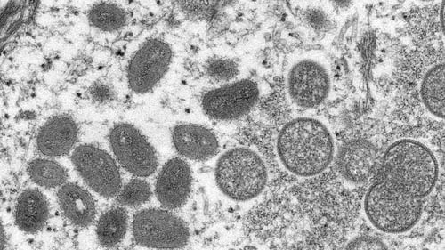 The monkeypox virus has been reported in the US and Canada, as well as Eutrope