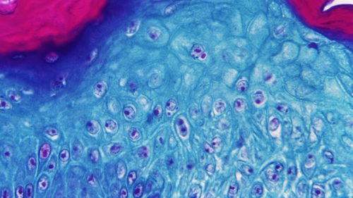 There are no known monkeypox cases in Ireland at present