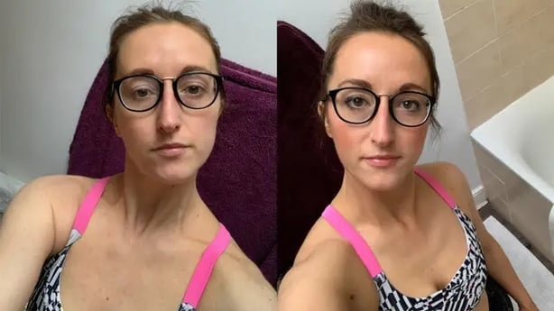 Before and after using Coco & Eve's Bali Bae Self-Tan set (Katherine Richardson/PA)