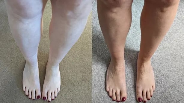 Before and after using Vita Liberata Tanning Mist (Claire Spreadbury/PA)