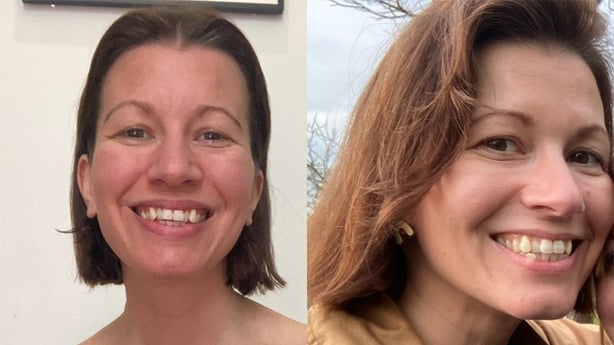 Before and after using Progressive Self-tanning Serum (Abi Jackson/PA)