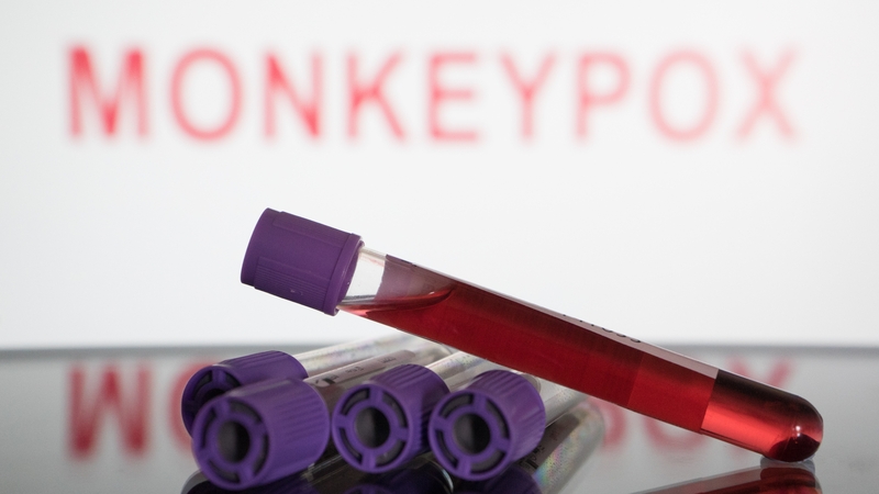 Most Of 39 Monkeypox Cases In Ireland Not Hospitalised   001bf36f 800 