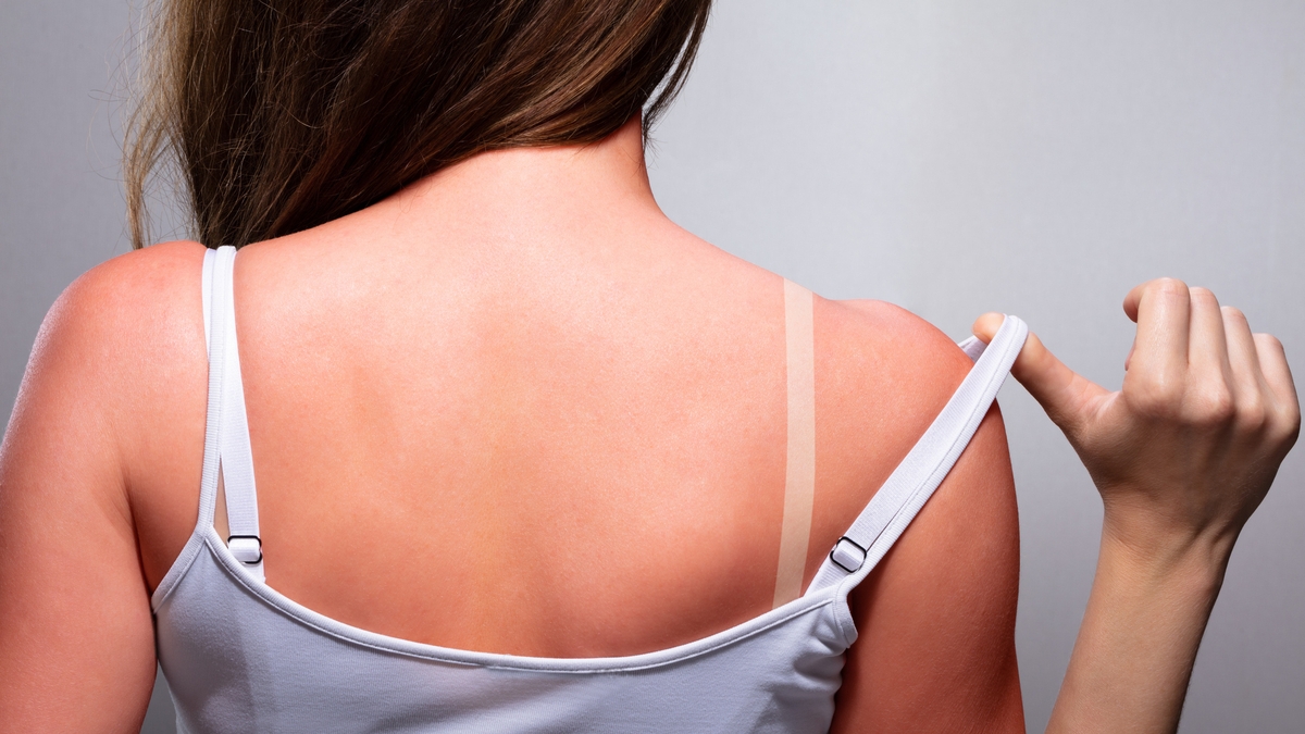 Skin Nerd - Summer Skin Hacks Skin Nerd - Summer Skin Hacks