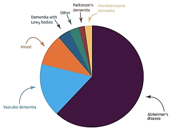 What Is Young Onset Dementia And What Causes It?