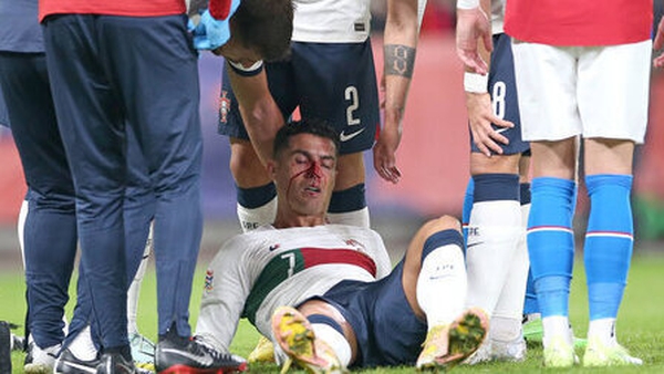 Cristiano Ronaldo suffered an injury in a clash with the Czech goalkeeper