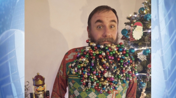 Man Breaks World Record For Christmas Baubles In Beard