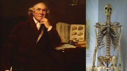Charles Byrne's skeleton was displayed in the Hunterian Museum until 2017, when the museum closed for refurbishment
