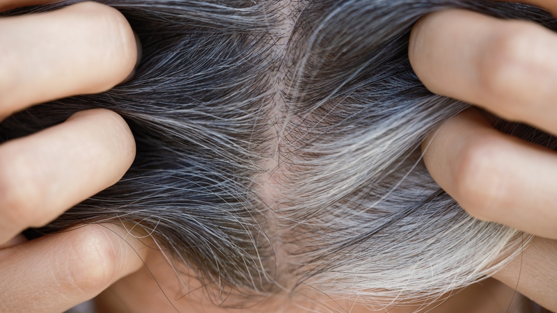 The study suggests stem cells may get stuck as hair ages and lose their ability to maintain their colour