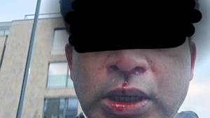 Racist Attacks