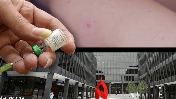 The World Health Organization (WHO) says there has been an 'alarming' rise in measles cases in Europe.