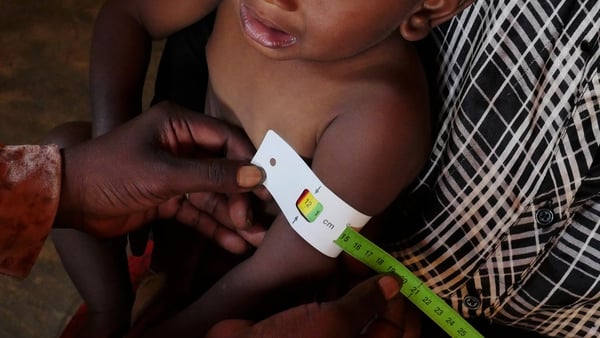A little girl is assessed at a clinic in Rotriak, South Sudan