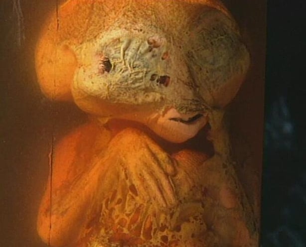 Alien Embryo claimed to have been discovered in a field in Bundoran, 1999