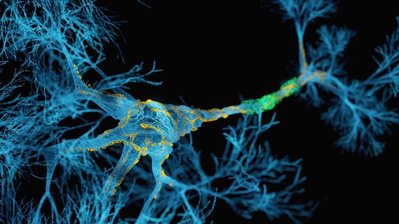 New research strengthens link between Epstein-Barr virus infection and Multiple Sclerosis
