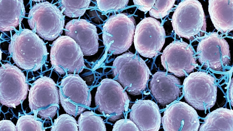 Over 20,000 cases of sexually transmitted diseases reported last year Over 20,000 cases of sexually transmitted diseases reported last year